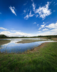 Sticker - Vertical shot of a pond surrounded by green grass and trees