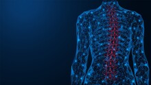 Scoliosis, Curvature Of The Spine. Incorrect Deformation Of The Human Back. Polygonal Design Of Interconnected Lines And Points. Blue Background.