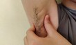 © Rung Kh - Portrait showing the fingers squeezing armpit hair under the arm, concept health care.