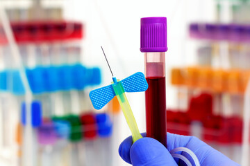 Sticker - Technician holding blood tube test and needle in the research laboratory. doctor hand taking a blood sample tube and needle with other color tubes for analysis in lab