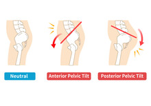 Relationship Between Pelvic Tilt And Posture..