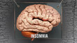 Insomnia anatomy - its causes and effects projected on a human brain revealing Insomnia complexity and relation to human mind. Concept art, 3d illustration