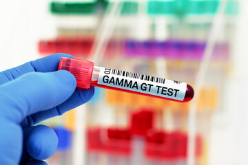 Wall Mural - doctor with Blood tube for Gamma GT GGT test in biochemistry lab. Blood sample of patient for Gamma GT GGT test in laboratory