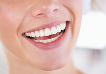 Canvas Print - A brilliant display of pearly whites. Close up of a womans sparkling teeth.