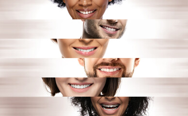 Wall Mural - Close-up male and female smiles of different ethnicity people