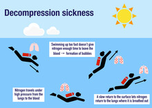 Infographic explaining the decompression sickness or divers disease
