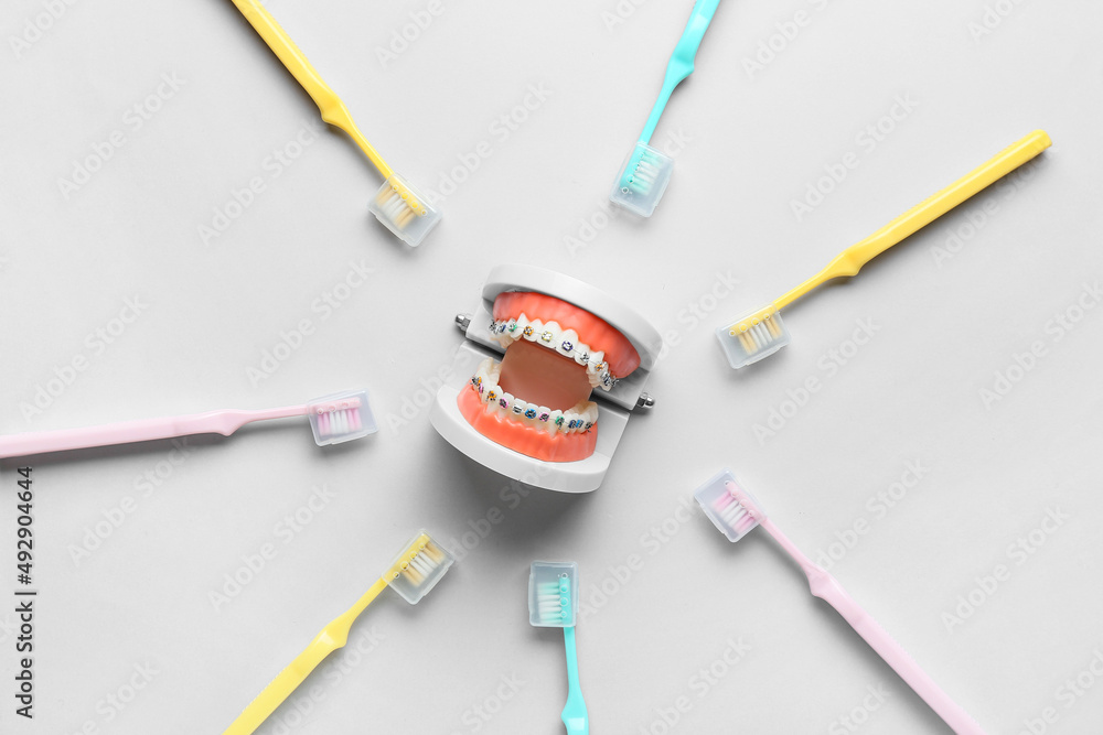 Model of jaw with dental braces and toothbrushes on light background