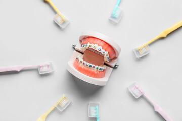 Wall Mural - Model of jaw with dental braces and toothbrushes on light background