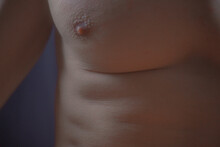 Male Health Body Part Chest Nipple 