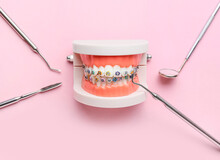 Model Of Jaw With Dental Braces And Dentist Tools On Pink Background