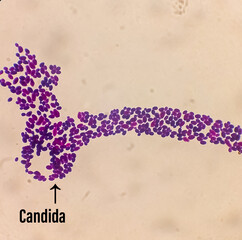 Wall Mural - Candida spp, fungi, emerging multidrug fungus. Candida albicans, C. auris and other yeast fungi. Close up micrograph