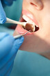 Dentist examining woman teeth in dental clinic