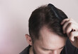 Man сombing hair on pastel beige background. Healthy hair, care concept. Closeup, top view, copy space
