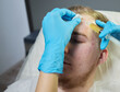 Injection at spa salon. Doctor hands in gloves. Closeup. Pretty male patient. Beauty treatment. Healthy skin procedure. Young man face. Plasmolifting rejuvenation.