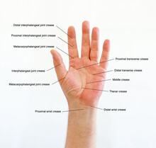 Diagram Of Hand Lines And Flexion Creases On The Right Palm With The Wrist In Sight Flexion Of Palm Surface For Medical Use.