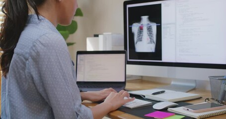 Clinical coder programmer improve future patient care service. Medtech big data tool developer automatic IT software lung X-ray covid analyze cloud computing typing python check code at home office.