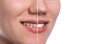 © alesmunt - Teeth of young woman before and after whitening, dental care and whitening teeth compare, panoramic image