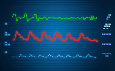 patient monitor showing vital signs ecg and ekg.