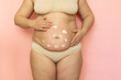 © Юля Бурмистрова - Cropped overweight woman in underwear applying moisturizer strokes gel to her abdomen. Belly fat removal. Wearing underwear, doing self massage to dehydrated skin. Cellulite obesity and striae problem