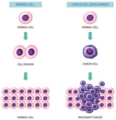 Canvas Print - Process of cancer cell development