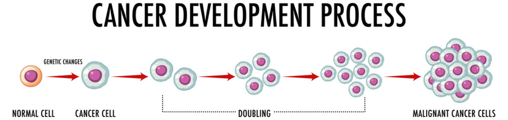 Canvas Print - Cancer development process infographic