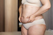 © Юля Бурмистрова - Cropped image of overweight woman, tucking, hiding fat naked big excessive abdomen with navel in underwear. Dangling down tummy. Drag away of abdomen. Folds hanging. Big size imperfection body care.