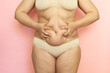 © Юля Бурмистрова - Squeeze woman sagging belly closeup, folds on tummy, loose skin and cellulite, obesity. Naked overweight plus size girl on pink background in beige underwear. Concept of dieting and body control.