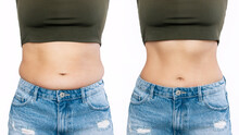Two Shots Of A Woman's Belly With Excess Fat And Toned Slim Stomach  Before And After Losing Weight Isolated On A White Background. Result Of Diet, Liposuction, Training. Healthy Lifestyle