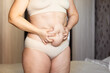 Cropped of overweight fat woman holding tummy excess flabs in underwear. Fast weight loss, showing cellulite. Obesity stomach, diastasis disease. Emphasizing excess adiposity, spare extra adiposity