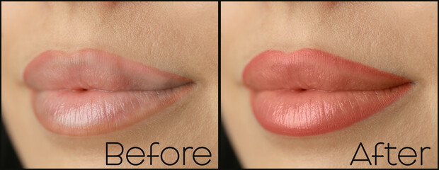 Poster - Collage with photos of young woman before and after permanent lip makeup, closeup. Banner design