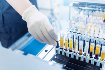 Wall Mural - scientist nurse downloads blood test samples to dna, hiv, aids, coronavirus on automatic biochemical