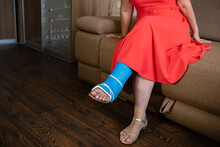 Modern Plastic Plaster. A Woman Sits On A Couch With A Plastic Blue Cast Wrapped Around Her Leg.