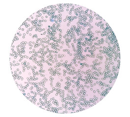 Poster - Close view of Reticulocyte count under microscope, methylene blue staining