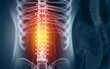 © Crystal light - Human spine pain, x-ray view, Spine injury pain. 3d illustration