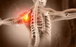 Human shoulder joint pain, x-ray view, shoulder ligament tendinitis, shoulder muscle strain. 3d illustration