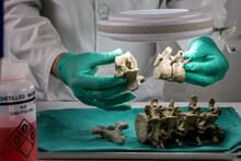 Forensic Scientist Comparing Two Human Vertebrae Of Adult Male Homicide Victims To Extract DNA, Forensic Lab, Conceptual Image
