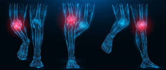 Polygonal vector illustration of human legs, inflammatory disease of the knee joint concept. Low poly art lower limbs on a dark blue background.