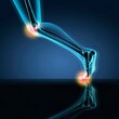 © SuperStock - X-ray view of a human's leg showing pain in knee, ankle and foot in running position