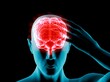 © SuperStock - X-ray view of a man grabbing his head in pain