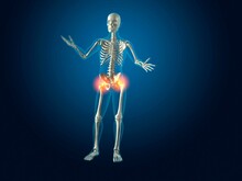 X-ray View Of A Human Skeleton With Hip Joint Inflammation