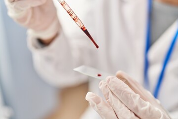 Poster - Young blonde woman wearing scientist uniform analysing blood at laboratory