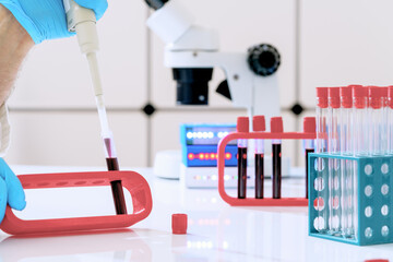 Wall Mural - Blood test for hormones and microelements in a biochemical laboratory. Test tubes with blood in the hand of a laboratory assistant and a microscope on the background