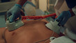 © stockbusters - Medical worker hands defibrillating unconscious man in emergency room closeup.