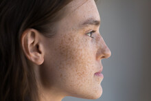 Thoughtful Freckled Teenage Girl Facial Close Up Side Portrait. Pretty Young Model Woman Clean Face With Fresh Clean Spotted Skin Looking Away, Thinking. Natural Beauty, Skincare, Cosmetology Concept