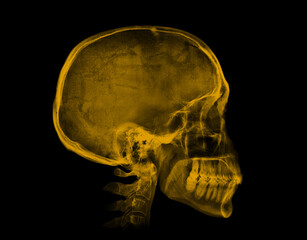 human skull. yellow x-ray image on black background