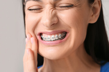 Beautiful woman with dental braces having pain in clinic, closeup