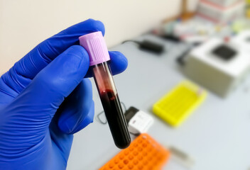 Sticker - Scientist or techinician hold levender tube with blood sample for hematological or whole blood test.