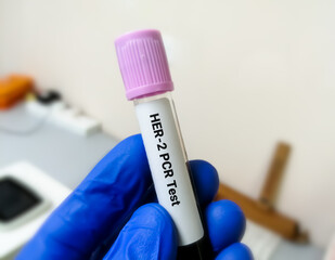 Poster - Blood sample for Her-2 or human epidermal growth factor receptor 2 PCR testing for breast cancer diagnosis.