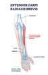 Extensor carpi radialis brevis muscle with arm and hand bones outline diagram. Labeled educational fusiform muscular system in lateral part of posterior forearm vector illustration. Wrist movement.