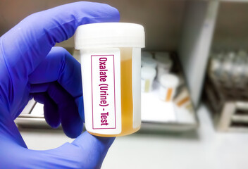 Sticker - Urine oxalate testing to diagnose secondary or primary hyperoxaluria, idiopathic hyperoxaluria or excess dietary oxalate or vitamin C intake.